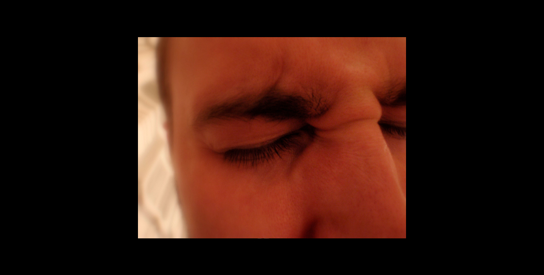 Rostro expresando con dolor de cabeza