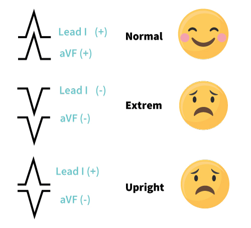 Cardiac Electrical Axis