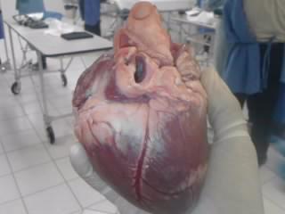 Human Heart